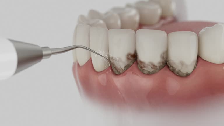 Trusted Wisdom Tooth Removal service in Gibraltar, MI - Dentist Open Now